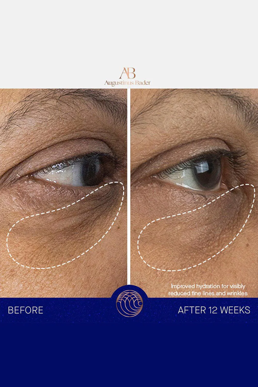 The Eye Cream 15ML - Image 5