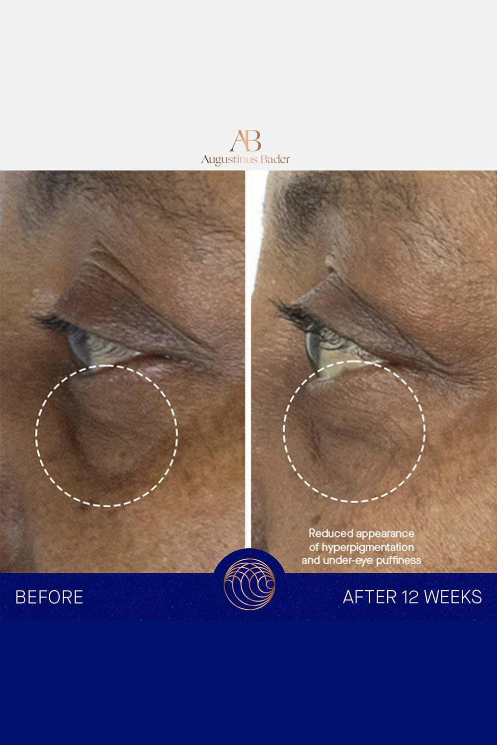 The Eye Cream 15ML - Image 7
